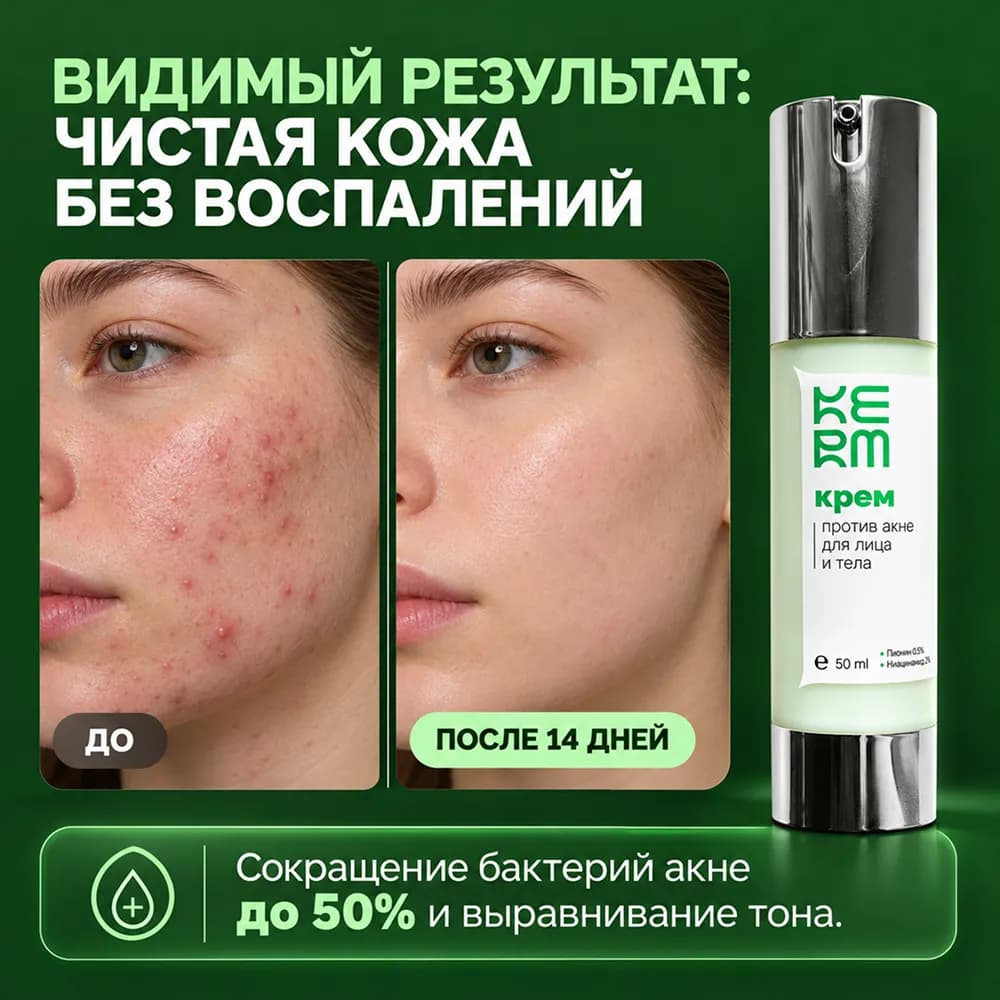 Крем для лица от акне